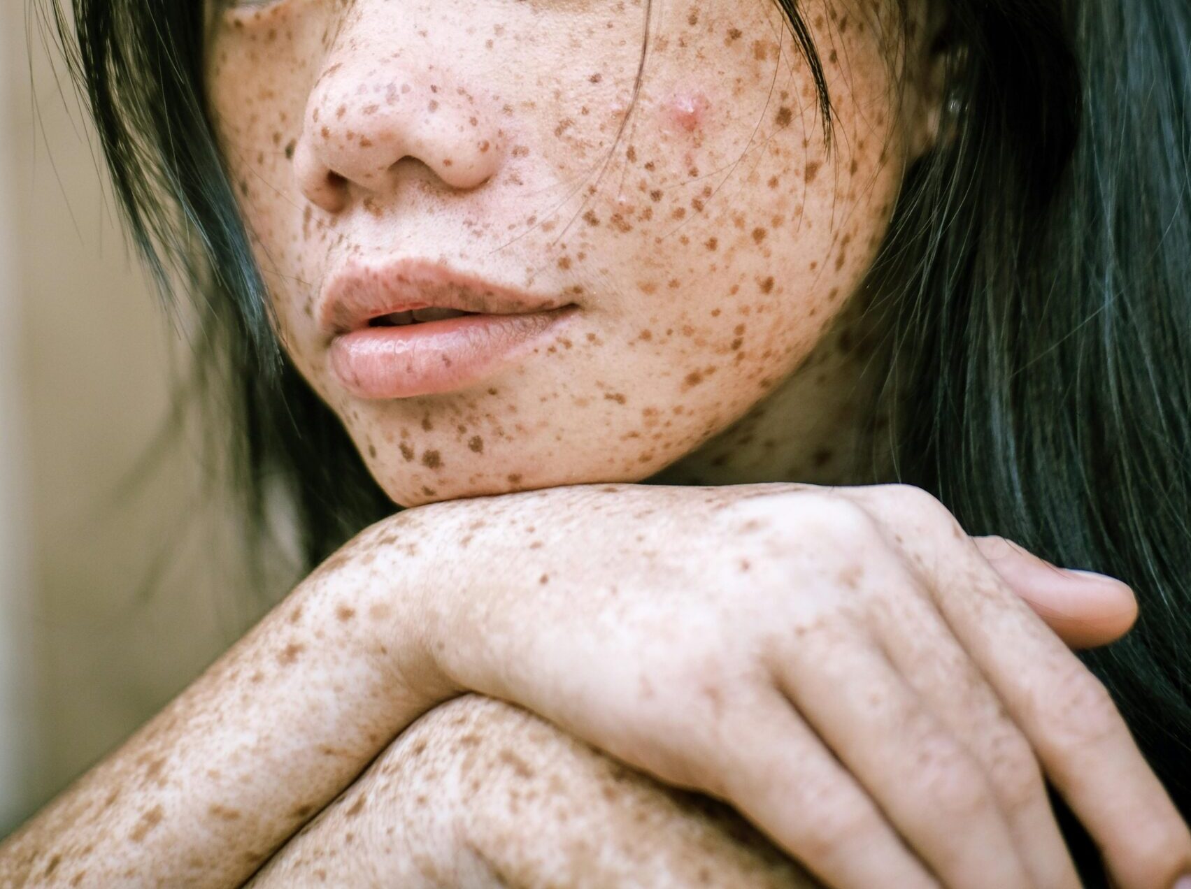 A virada de chave no autocuidado Intimate portrait highlighting the unique freckles and natural beauty of a young woman.